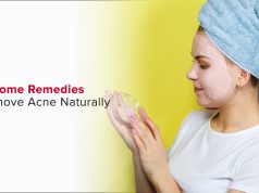 10 Easy and Natural Ways to Get Rid of Acne