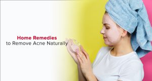 10 Easy and Natural Ways to Get Rid of Acne