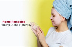 10 Easy and Natural Ways to Get Rid of Acne