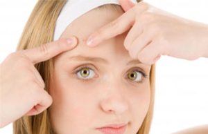 5 Natural and Non-Natural Acne Treatments