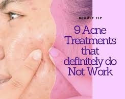 9 Acne Treatments That Definitely do Not Work