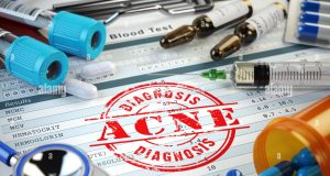 About Acne: Getting the Most from Your Doctor