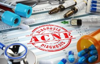 About Acne: Getting the Most from Your Doctor