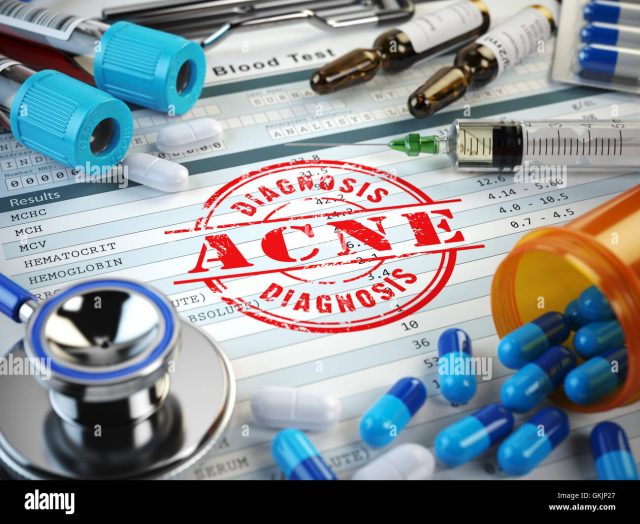 About Acne: Getting the Most from Your Doctor